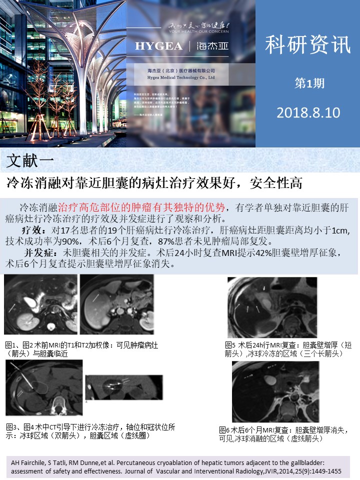【海杰亞科研資訊】第1期——肝、肺癌消融